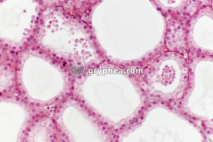 Glande lacrymale x100 - gryphea.com